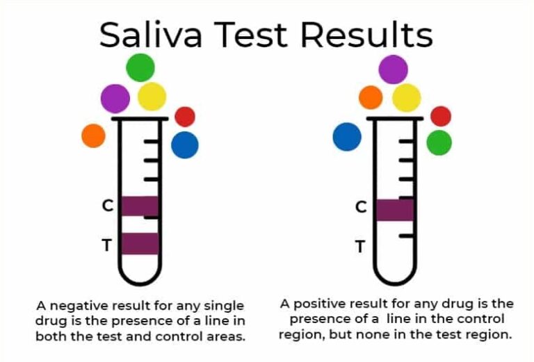 Mouth Swab Test Results