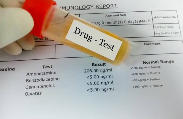 An illustration showing body fluids used in drug tests